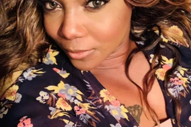 Prodajem silikone, malo prešli, očuvani! Žena preko fejsa prodavala implante