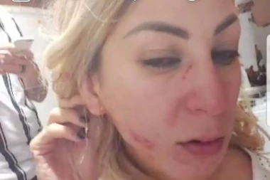 Udarao me je u glavu, stomak i u nogu! Ceo stan mi je krvav: Nadežda Biljić završila u Urgentnom centru!