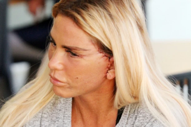 MOŽEŠ LI DA SE POMERIŠ OD PLASTIKE? Starleta uhvatila ćerku (15) pod svoje nagovara je na operacije, ona je POSRAMILA!