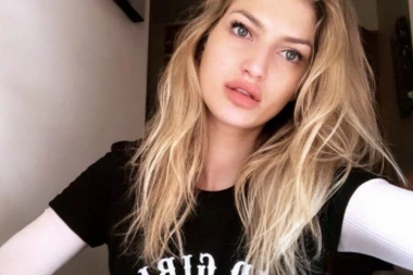 (FOTO) SRPSKA MANEKENKA UMALO OSTALA NEPOKRETNA NAKON STRAŠNE NESREĆE! Oporavak je bio TEŽAK, a ONA sada izgleda NIKAD BOLJE!