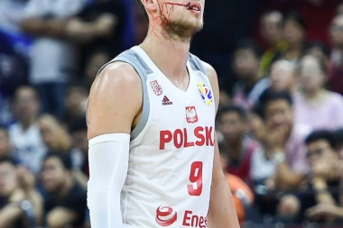 (FOTO) Ponitka: Krv, šavovi i možda Srbija