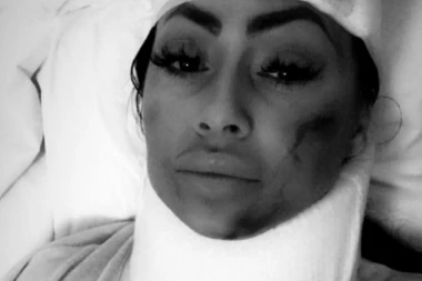 Jedva spasla živu glavu: Bivša ljubav Darka Lazića doživela udes!