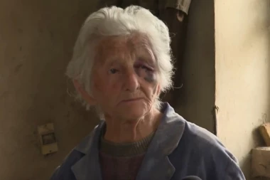 (VIDEO) Ovo je baka koju su prebili zbog 3.000 dinara, lice joj unakaženo