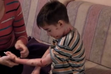 Srbija u suzama! Mali Despot (12) preminuo