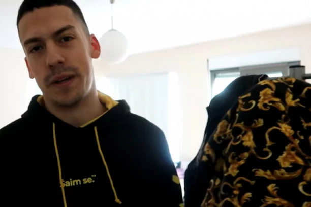 (FOTO) BAKA PRASE IMAO OPERACIJU: Jutjuber više ne izgleda isto!