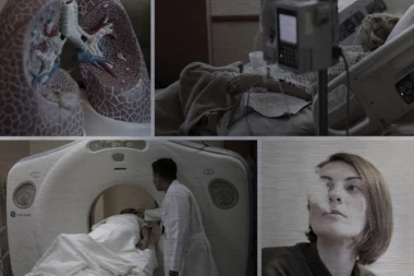 NAJCRNJE BROJKE! Rak kosi Srbiju: Od opake bolesti oboli 36.000, umre 22.000 ljudi