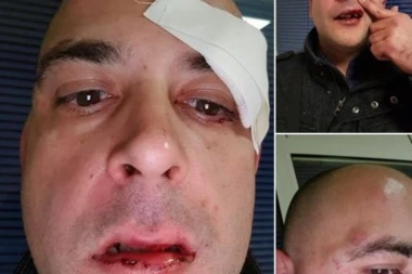 Usijane glave ovde često dolaze! Radnici picerije otkrili detalje krvave drame u kojoj je Ilija izvukao deblji kraj