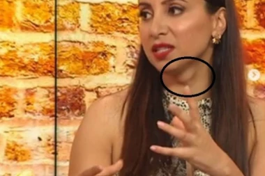 (FOTO) Gledateljka u TV prenosu primetila neobičnu izbočinu na vratu voditeljke i tako joj spasila život