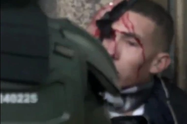 (VIDEO) Troje mrtvih u Kolumbiji na protestima zbog javnog prevoza