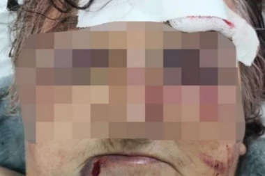 Pozvala sam je i čula vrisak! Živadinkina ćerka otkrila šta se desilo u kući strave u Šapcu, monstrum je izdeformisao ženu od batina