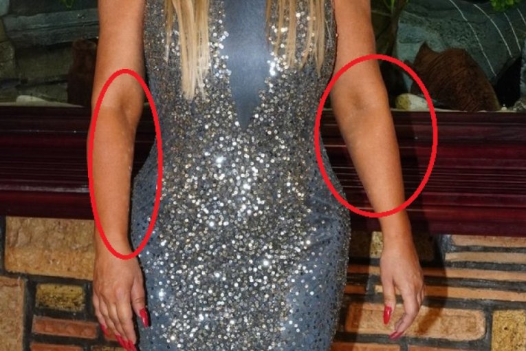 ...ali kada je pogledate izbliza to izgleda šokantno