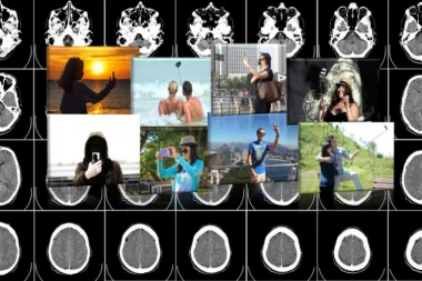 Selfimanija nije samo mentalni, već sve više i fizički problem