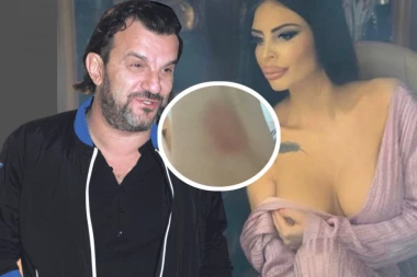 SKANDALOZNO! Devojka sa kojom se viđa Aca tvrdi: Tukla sam se sa Lukasom!