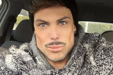 Hodajući KEN: On je apsolutni rekorder na Balkanu po broju plastičnih operacija i erekcija!