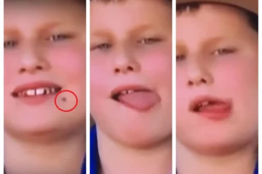 (VIDEO) Klinja u lajvu tamanio muve kao ŽABA