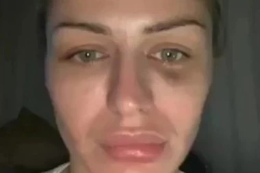 DANAS NE SLAVIM SAMO ROĐENDAN... Naša manekenka nakon brutalnog NASILJA stvorila mir! (FOTO)