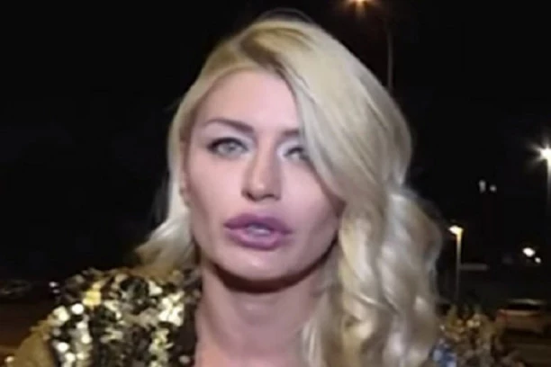 (FOTO) SANDRA OBRADOVIĆ NAPADNUTA: Oglasila se i otkrila detalje!