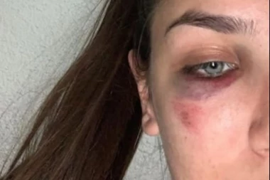 (FOTO) Karatistkinje BiH pretučene u svom domu: "Žrtve smo nasilja jedne pijanice"