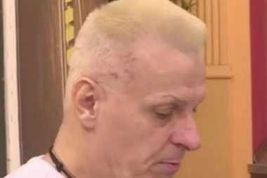 (FOTO) OSVANULA UZNEMIRUJUĆA SLIKA ĐORĐA DAVIDA! Unakaženo lice, krvav i modar - SVI U NEVERICI KO MU JE TO URADIO IZNENADA!