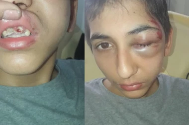 Srbin koga je pretukla policija u Parizu je operisan: Narednih 24 sata ključni