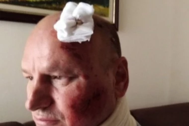 (FOTO) Društveni talog! Novosađanina udarila kola, a dok je ležao bespomično "udaren" je i po džepu!