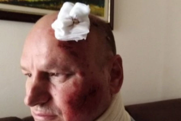 (FOTO) Društveni talog! Novosađanina udarila kola, a dok je ležao bespomično "udaren" je i po džepu!