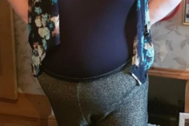 (FOTO) Imala je 164 kilograma i predviđali su joj skoru smrt: Onda je Hana promenila samo jednu stvar i napravila nešto neočekivano