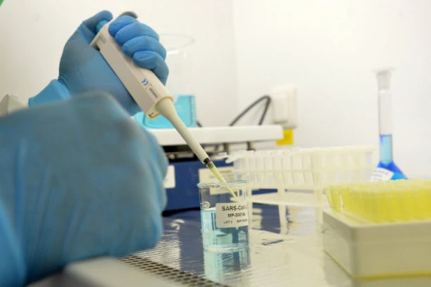 ŠOKANTNO SAZNANJE: Naučnici autopsijom otkrili da koronavirus dramatično utiče na krv