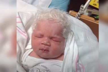 (VIDEO) Nesvakidašnji prizor: Beba se rodila sa skroz SEDOM KOSOM, prozvali su je "mali princ"