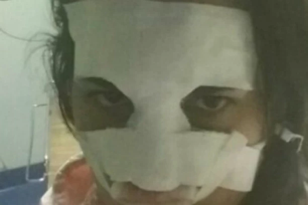 (FOTO) ĆERKA NAŠE POZNATE GLUMICE MONSTRUOZNO PRETUČENA! Odbila udvarača pa dobila batine!