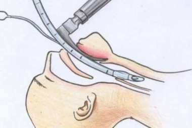 EVO KAKO JE BITI NA RESPIRATORU! Šok OBJAŠNJENJE potreslo GRAĐANE