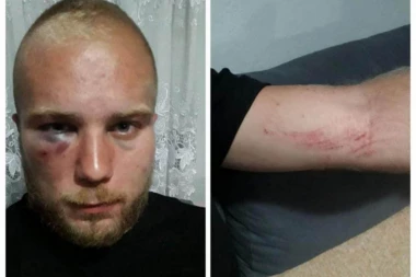 MEĐUNACIONALNI SKANDAL U BJELOM POLJU! 10 muslimana KUKAVIČKI pretuklo mladića: Psovali mu "srpsku majku"