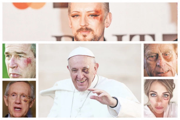 ŠLJIVA ISPOD OKA za ulazak u tajno društvo: Iluminati imaju poseban kriterijum za pristupanje bratstvu