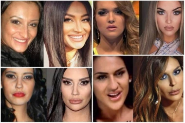 POZNATI BI OVE FOTKE NAJRADIJE SPALILI! Hirurzi - SVAKA VAM ČAST!