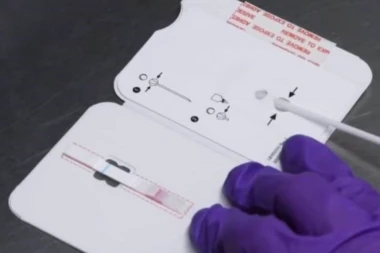 Srbija bolja od Nemačke kad je u pitanju testiranje na koronu