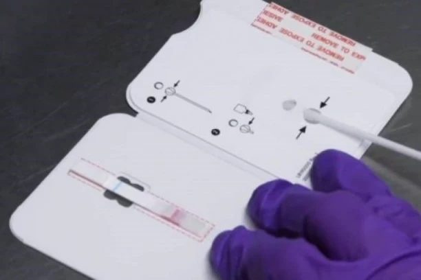 Slovenija od danas ponovo priznaje PCR testove iz Srbije