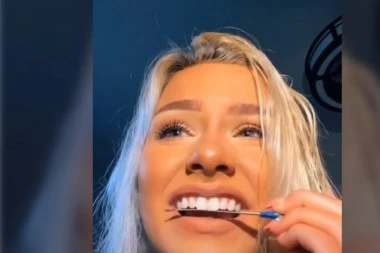 (VIDEO) Bizaran trend opasan po zdravlje zuba sve više se širi društvenim mrežama