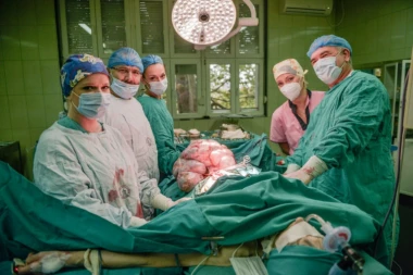 (FOTO) NESTVARAN PODVIG LEKARA URGENTNOG CENTRA: Pacijentkinji odstranili tumor TEŽAK 12 KILOGRAMA!