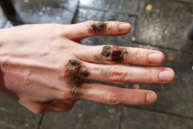 (FOTO) MIGRANT NAPAO DEVOJKU USRED BEOGRADA: Bacio je na pod i uhvatio za vrat, OVO je tražio od nje