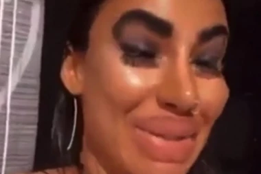 Ona ima najveće silikonske usne na Balkanu: Starleta iz Bugarske zapalila Instagram, a tek da vidite njene snimke!