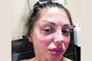 POTRESNA ISPOVEST MAJE MARINKOVIĆ: Kada je Janjuš video da mi od udaraca ostaju modrice, onda je počeo da mi čupa uši