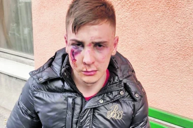 OTAC U NEVERICI: MIGRANTI MI PREBILI SINA! POLOMILI MU KOSTI, JEDVA PREŽIVEO