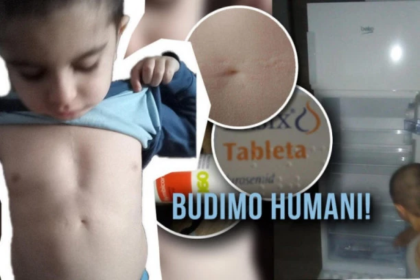 POMOZIMO KOLIKO MOŽEMO! MALI FILIP (4) KAO JUNAK POKAZUJE OŽILJKE OD OPERACIJE SRCA: A njegovu mamu BOLI SRCE jer im je frižider PRAZAN!