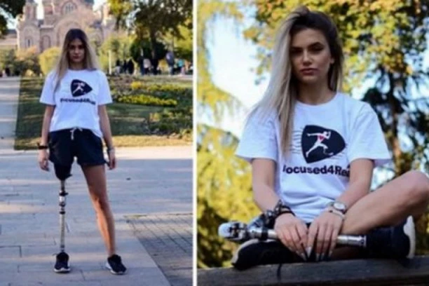 (FOTO) OSTALA SAM BEZ NOGE, ALI SAM IZ SVEGA ŽELELA DA IZAĐEM KAO POBEDNIK: Marijina potresna ispovest tera suze na oči, SRBIJA JOJ MORA POMOĆI!