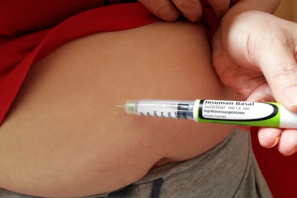 PREPOZNAJTE DIJABETES NA VREME: Ruski endokrinolog opisao prve simptome ove bolesti!