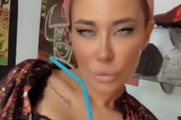 (FOTO) UBRIZGAVA KRVNU PLAZMU ZBOG LEPOTE! Ana Nikolić ZGROZILA JAVNOST izgledom!