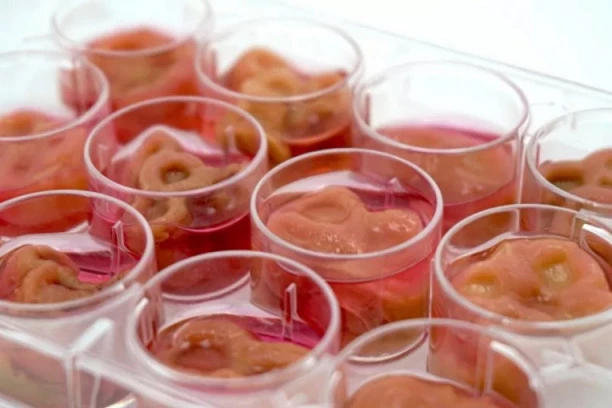 ŽAO VAM JE ŽIVOTINJA? NAPRAVITE HRANU OD SEBE! Američki naučnici promovišu koncept ishrane LJUDSKIM mesom!