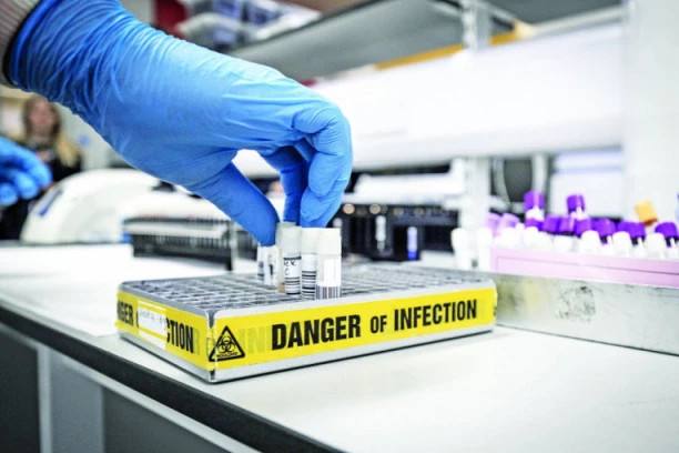 PANIKA U EVROPI! Veoma opasan i zarazan virus registrovan u Španiji: Stopa smrtnosti je 88%, nema vakcine, NI LEKA!