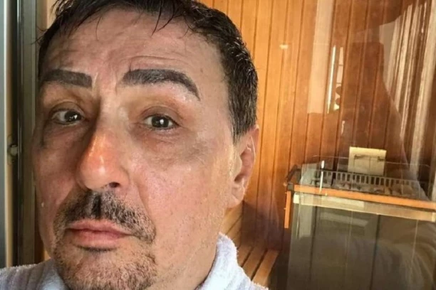 KEBA POKREĆE NOVI BIZNIS - Evo kako za 55 dinara održava MLADALAČKI IZGLED!