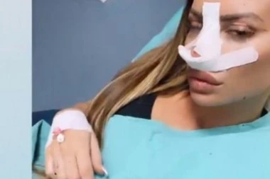 Mogla je kola da kupi: Dragana Mitar otkrila koliko je novca dala za SVE PLASTIČNE OPERACIJE!